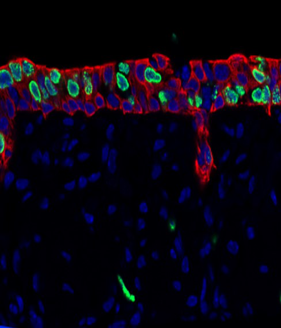 1531996819465090dIET.png 82.png